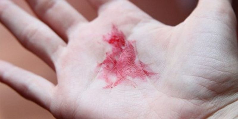 Mơ thấy máu đánh con gì khi dính ra tay